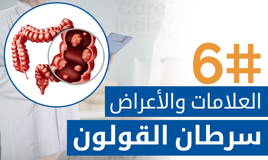 ستة اعراض سرطان القولون تقوم بتحذيرك